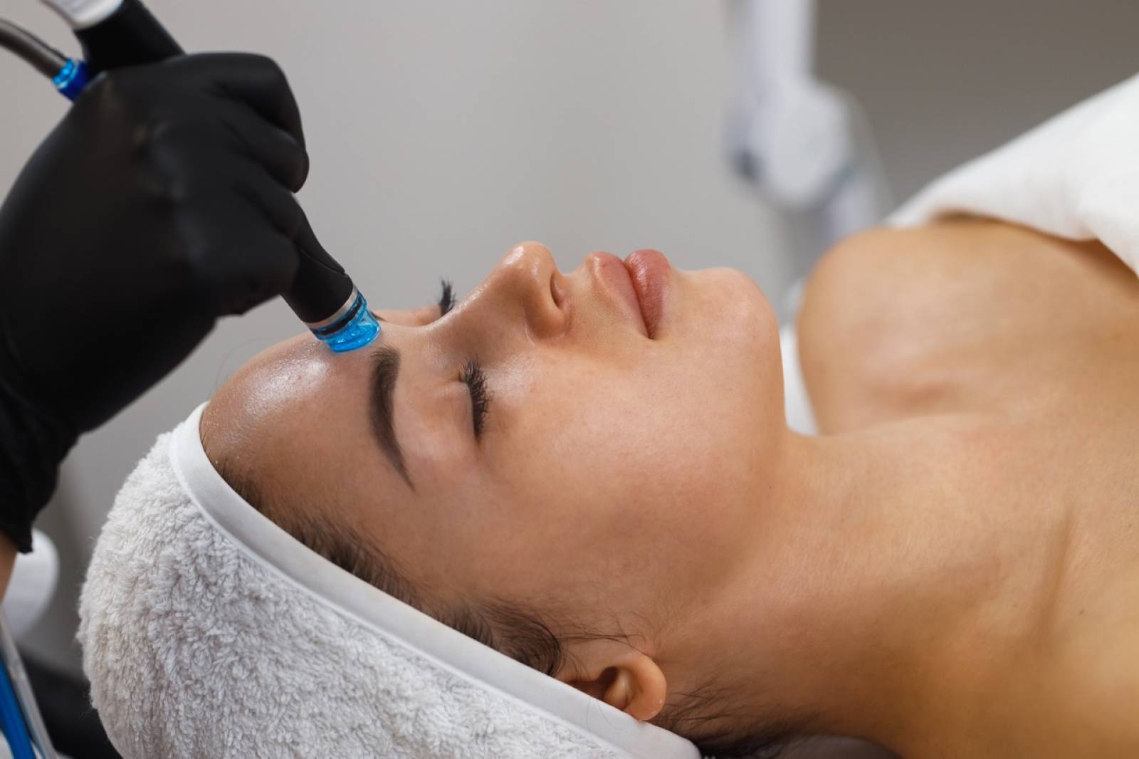 Quelle est la différence entre l’Hydrafacial et le Microneedling à Aubagne ?